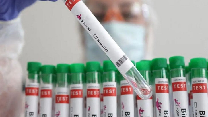 ভারতে বার্ড ফ্লুর হানা, বিহারে জরুরি সতর্কতা জারি – DesheBideshe